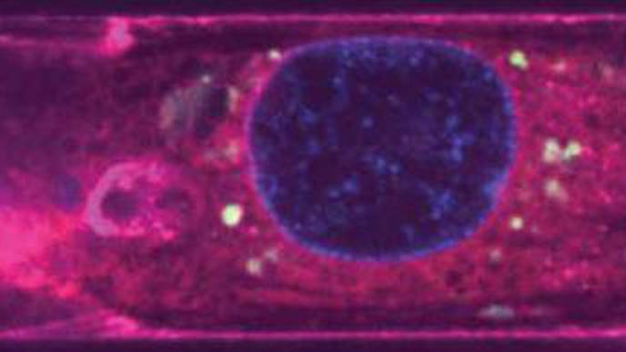 Reviving Cells After a Heart Attack