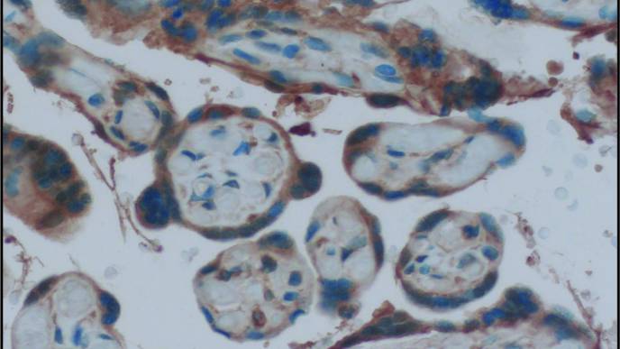 Estrogen Receptors in Mom’s Placenta Critical During Viral Infection