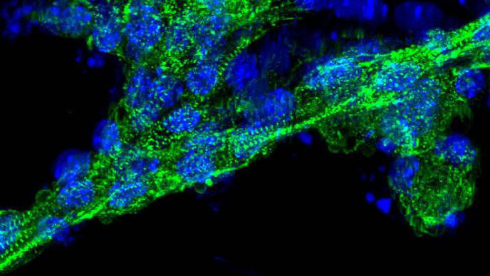 Engineered Cells Successfully Treat Cardiovascular & Pulmonary Disease