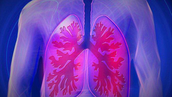 What Is Causing Long-Term Lung Damage in Asymptomatic COVID-19 Cases?