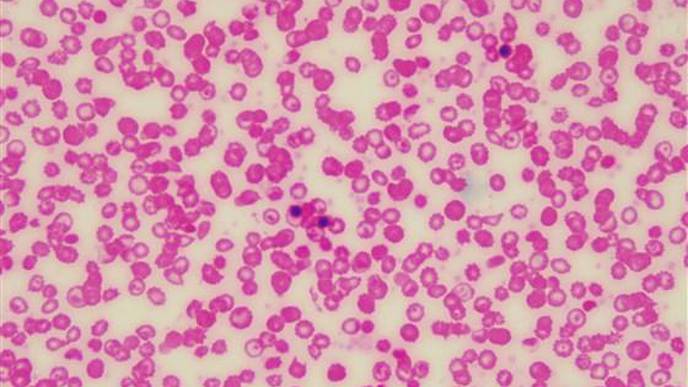 Covid-19 Wasn't the Only Medical Story This Year. Here's What You Missed in 2020.