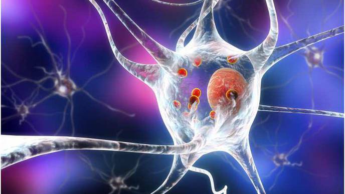 Function Identified of 'Mystery Protein' That Kills Brain Cells of People with Parkinson's