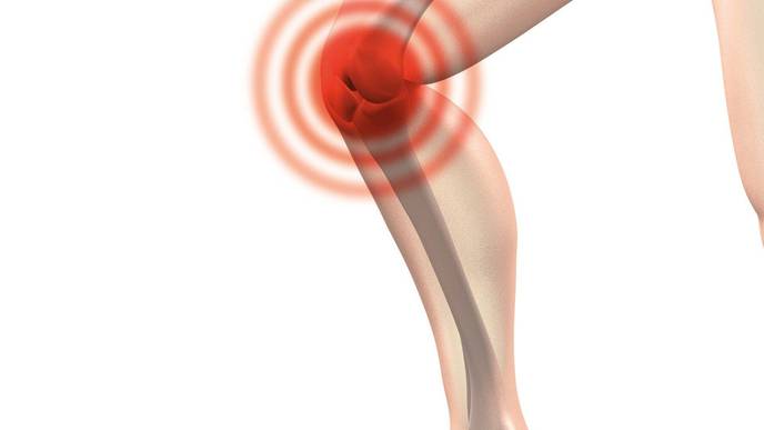 Non-Surgical Treatment Quickly Reduces Arthritis Knee Pain & Improves Function