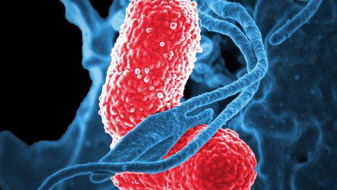 Study on the Effect of Rosemary & Ginger Essential Oils Against Klebsiella Pneumoniae
