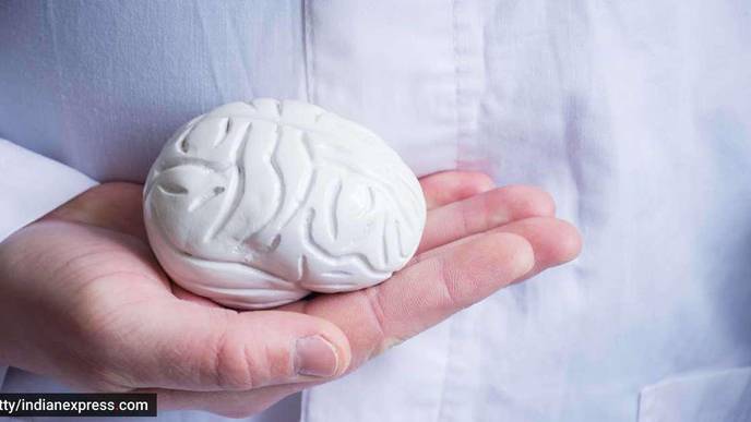 Flow Diverter Mechanism Finding Favor in Tackling Brain Aneurysms