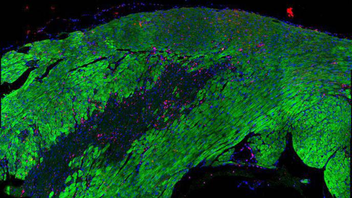 Researchers Map Heart Recovery After Heart Attack with Great Detail
