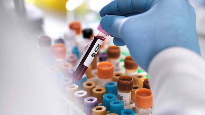 Doctors Say Experimental Treatment May Have Eliminated Man's HIV