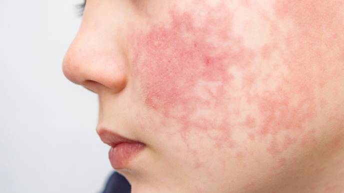 ReachMD Healthcare Image