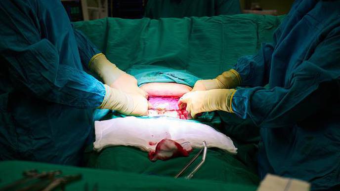 Unnecessary C-Sections Are a Problem in the US. Will Publicizing Hospital Rates Change That?