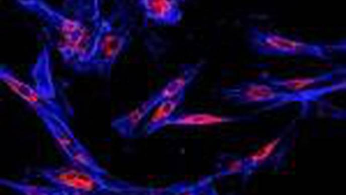Researchers Identify a Novel Vulnerability in Advanced Prostate Cancer