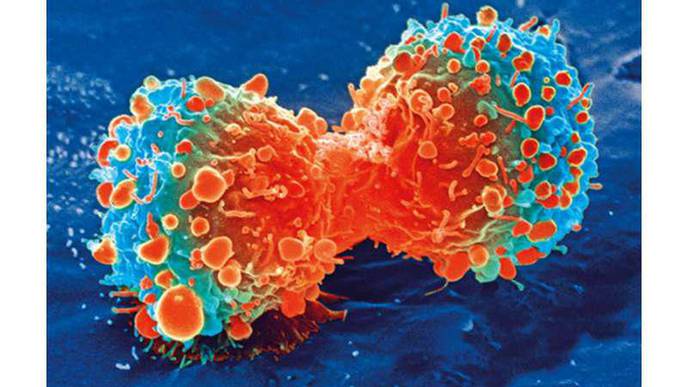 Researchers Identify Potential Revolutionary New Drug Treatment for Fatal Childhood Cancer