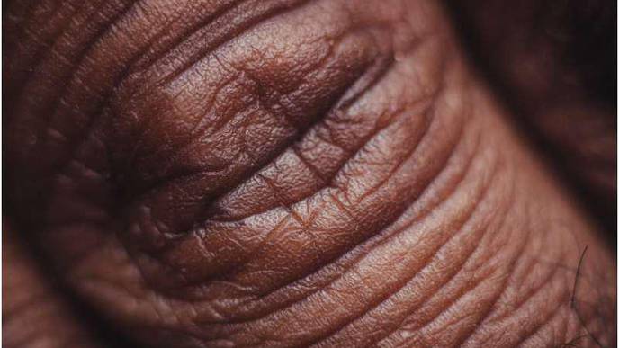 Scientists Cast New Understanding of How Skin Repairs Itself