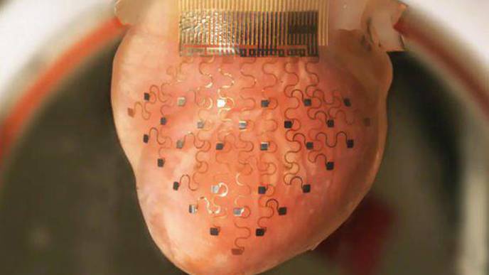 Live Forever: ‘Significant Progress’ on 3D Printed Electronic Sleeve for Eternal Heartbeat