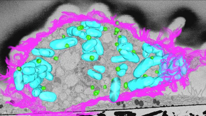 Fats Fghting Back Against Bacteria
