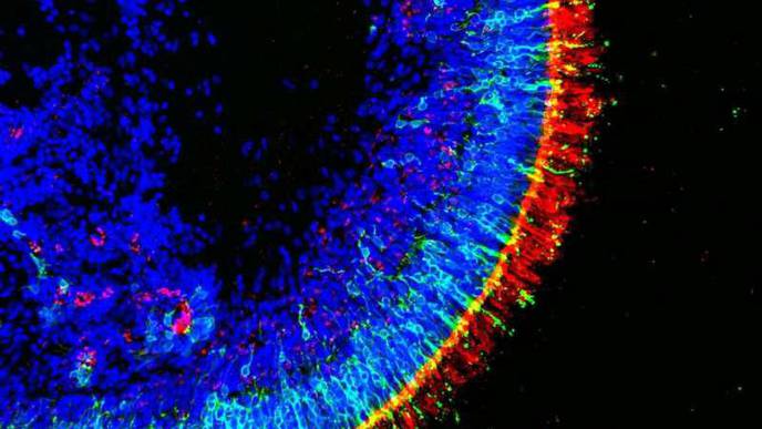 Scientists Create Functional Human Retinas in a Dish