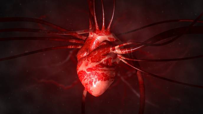 Study: COVID-19 Patients Rarely Survive Cardiac Arrest