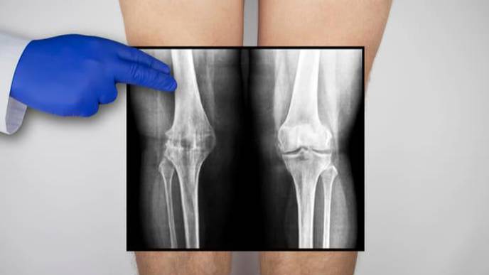 Natural Cartilage Matrix Suitable as a Biomaterial for Improved Cartilage Regeneration