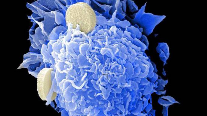 Multimodal Therapy May Hold Key to Treating Aggressive Childhood Cancer