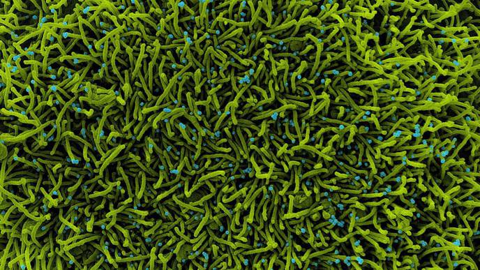 NIH Experts Discuss SARS-CoV-2 Viral Variants