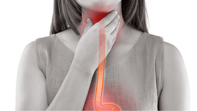 Study Shows Rising Incidence of Esophageal Adenocarcinoma in Younger Adults
