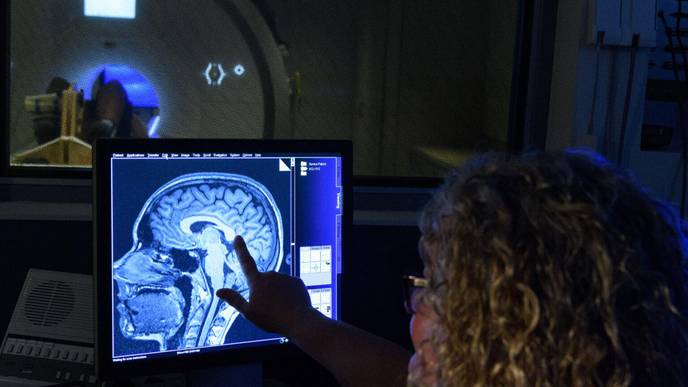 More Than a Knee Injury: ACL Tears Cause Harmful Changes in Our Brain Structure