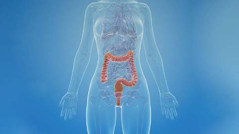 Weighing the Evidence: A Case-Based Review in Ulcerative Colitis