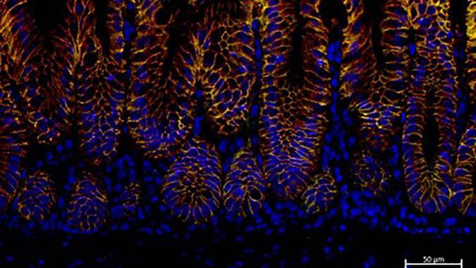 Superbug Impact on the Gut