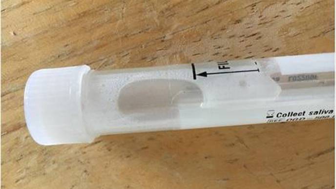 Saliva Promising Alternative to Upper Airway Swabs for Diagnosis of SARS-CoV-2