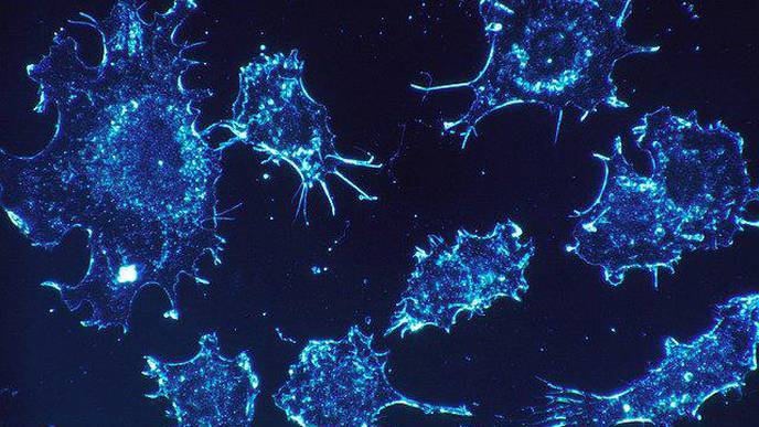 Study: Cheese Preservative Slows Oral Cancer Spread in Mice