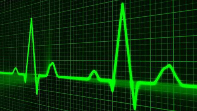Study: Simple Surgical Procedure Reduces Stroke Risk in People with AFib
