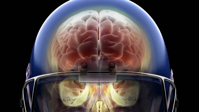 Light Therapy is Safe, Modulates Brain Repair, & May Benefit Patients With Moderate TBI