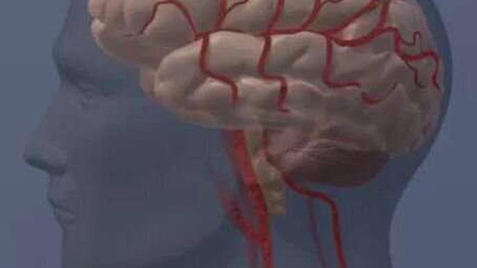 Retinal Damage May Signal Higher Risk of Stroke, Dementia, & Early Death