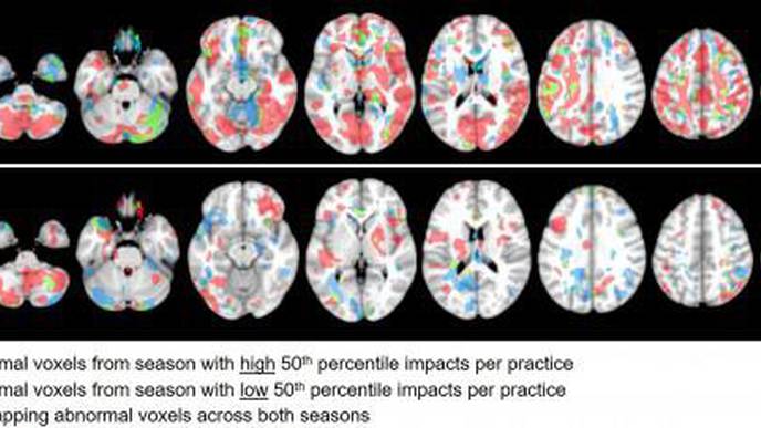 Associations Between Head Impact Exposure & Abnormal Imaging Findings in Youth Football Players Over Consecutive Seasons