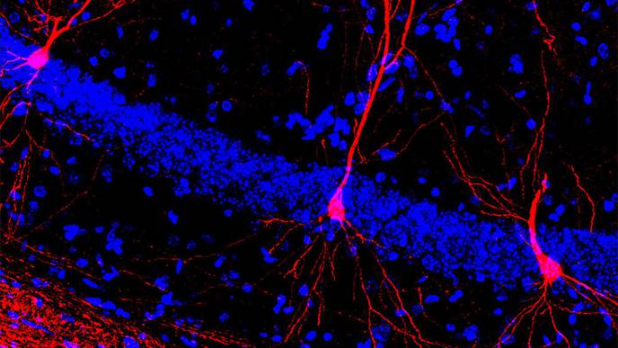 Behavioral Training Could Help Babies with Rett Syndrome, Mouse Study Suggests