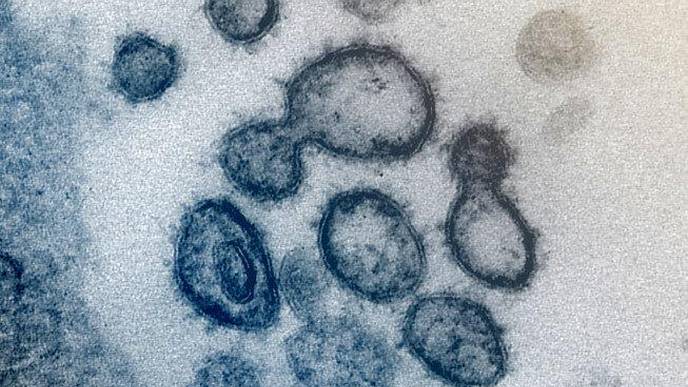 Even Mild COVID-19 Illness May Confer Some Immunity