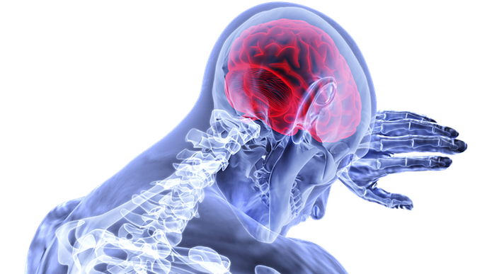 Clot Permeability Linked to First-Attempt Success of Aspiration Thrombectomy