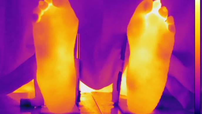 Higher Body Temperatures Still a Factor in Patients in Remission from Rheumatoid Arthritis