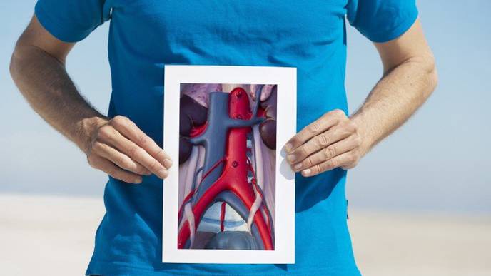 Aortic Aneurysm in Older Men Associated with Levels of Certain Subtypes of White Blood Cells