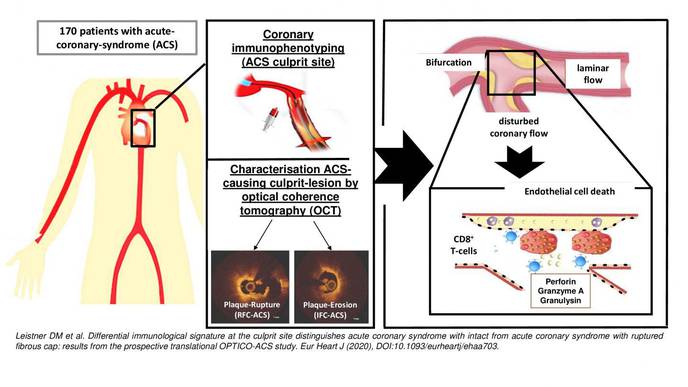 Tracking Down the Causes of Heart Attack