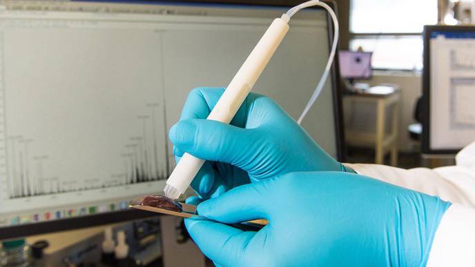 MasSpec Pen Shows Promise in Pancreatic Cancer Surgery