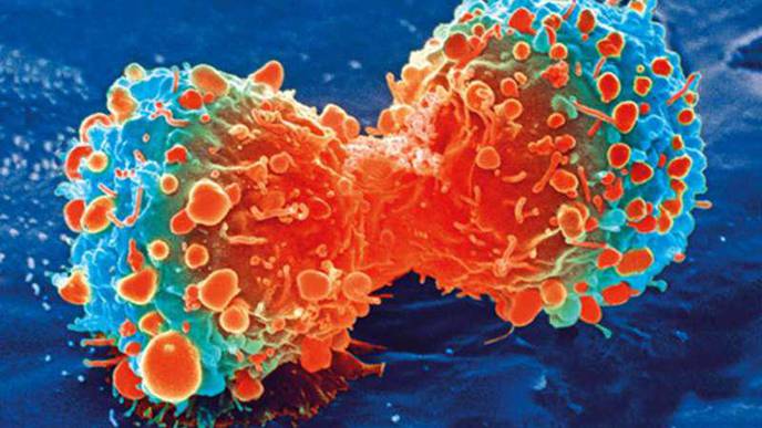 Cancer Patients Over 65, on Multiple Medicines, Are at Higher Risk of Hospitalization