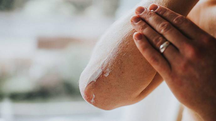 Heart Risk Factors May Be Especially Unhealthy in Psoriasis Patients