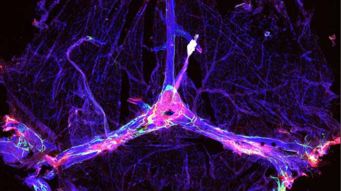 Brain’s Waste Removal System May Offer Path to Better Outcomes in Alzheimer’s Therapy