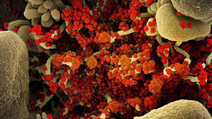 Treatments for People with Early COVID-19 Infection Is an Urgent Research Focus