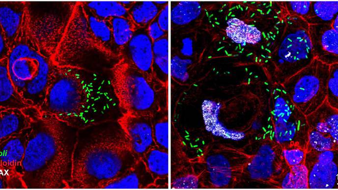 Genotoxic E. Coli 'Caught in the Act'