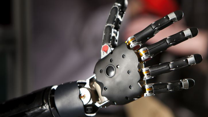 Could Prostheses Alleviate Amputees’ Phantom Limb Pain?