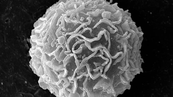 Probiotic Bacteria Shown to Suppress Growth of Tumors in Colorectal Cancer