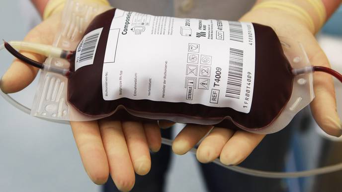 Reducing Need for Blood Transfusion during Heart Surgery Is Focus of New Practice Guideline