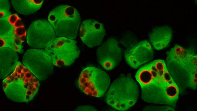 New Genetic Test Could Help Identify 'Ultra High Risk' Bone Marrow Cancer Patients