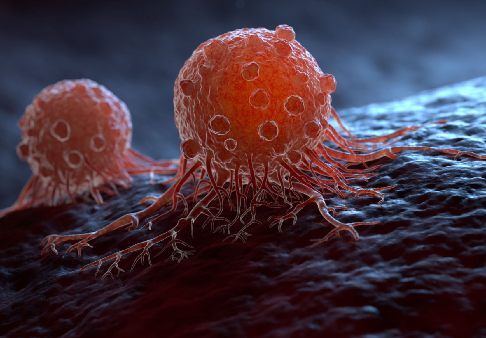 CT-Based Radiomics Deep Learning to Predict Lymph Node Metastasis in ...
